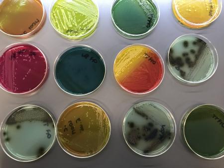 Multicolored microbiology media plates